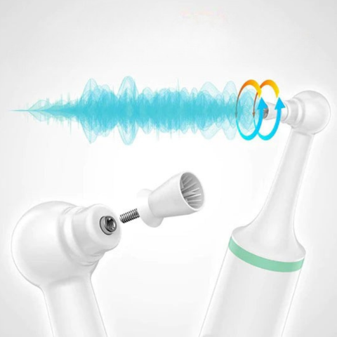 Elektromos fogkőoldó - szájhigiénia és sugárzó mosolyok